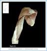 10_36BA_Triceps_AUN