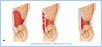 10-11bAbdomWall_UN