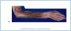 10-16cPosForearm_UN