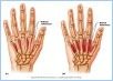10-18_HandMuscl_2_L
