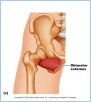 10-20cPostHipThigh_L