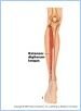 10-21dMuscAntLeg_L