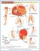10-T16cSumThighFoot_TAB