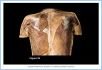 10_32BA_PosThoraxMusc_AUN