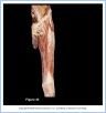 10_40BA_LowerThigh_AUN