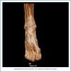 10_43BAaAntFoot_AUN