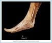 10_43BAbAntFoot_AUN